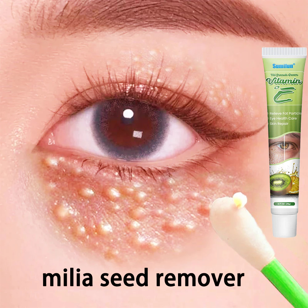 SHVA. obat milia di bawah mata cream milia penghilang milia Eye cream obat milia remover Benjolan