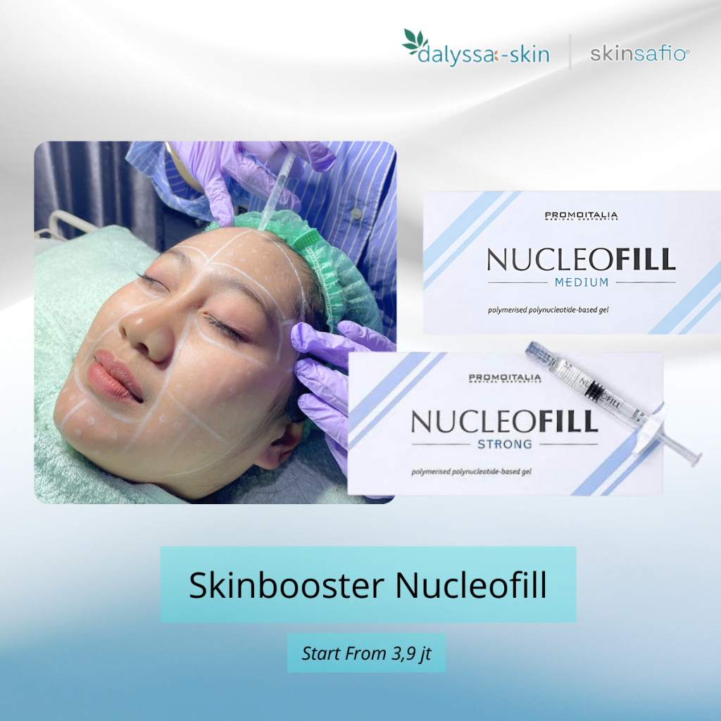 Skinbooster Nucleofill