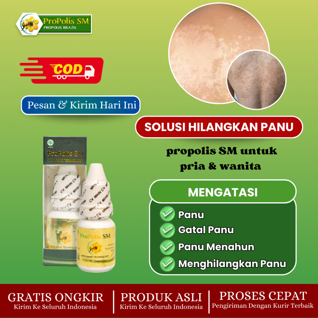 Propolis SM Obat Panu, Penghilang Panu, Obat Panu Cair, Obat Jamur Kulit, Obat Gatal Panu Isi 6 Ml