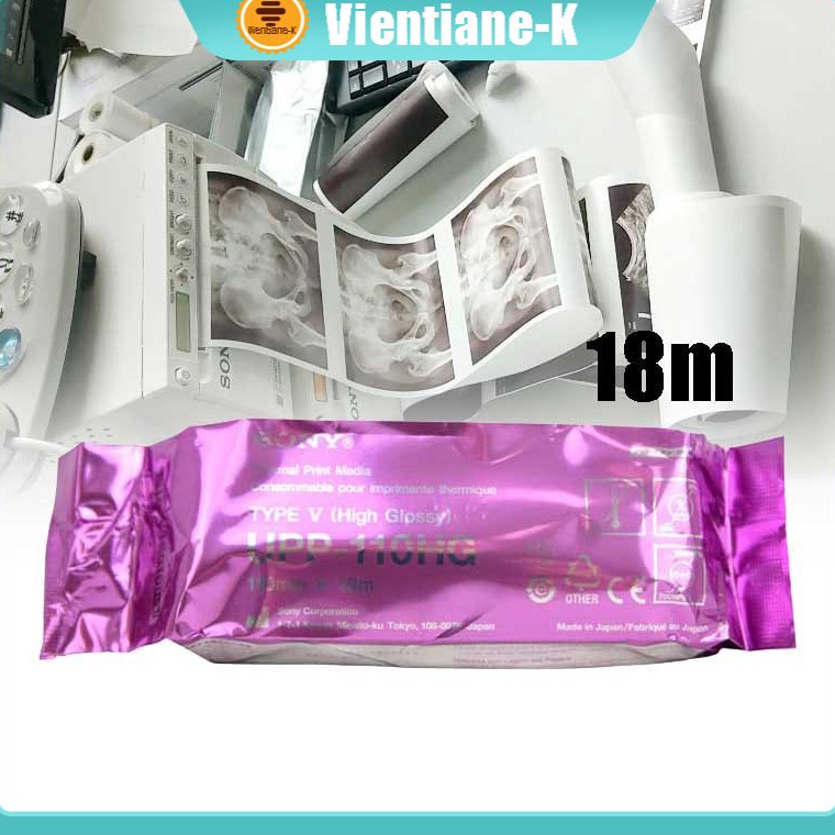 

KODE PRODUK PZWRE7945 Kertas USG Sony UPP 11HG Printer USG Sony Paper Sony Type V High Glossy