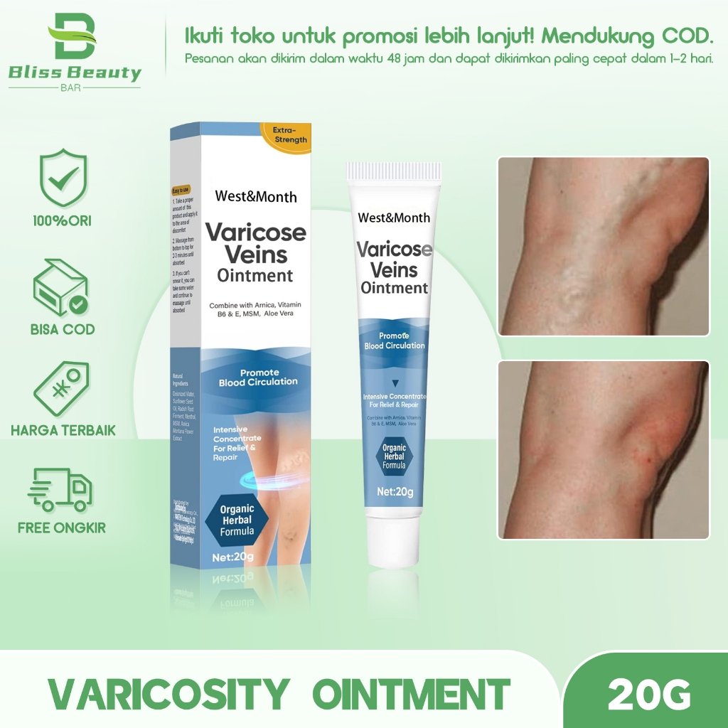 West&Month Varicose Vein Relief Cream Remove Angiitis Phlebitis Improve Vessel Dilated Relieve Spide