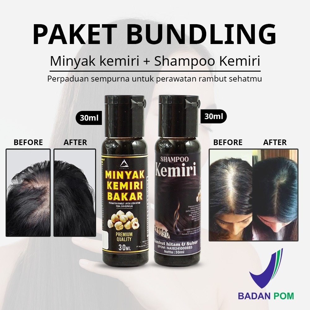 Paket 2in1 Shampoo & Minyak Kemiri Penumbuh Rambut Cepat Penghilang Uban Dan Rontok 30ml - BPOM