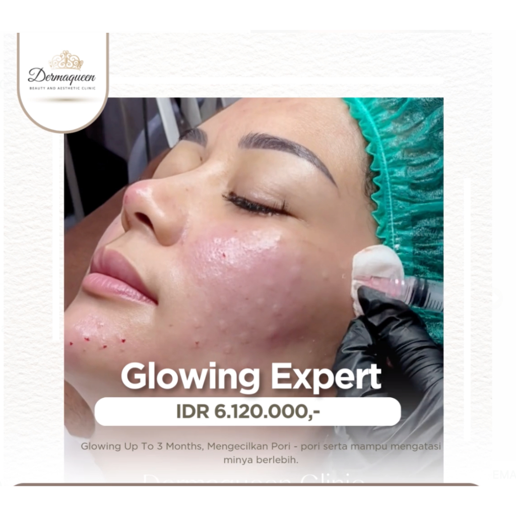 TREATMENT GLOWING EXPERT