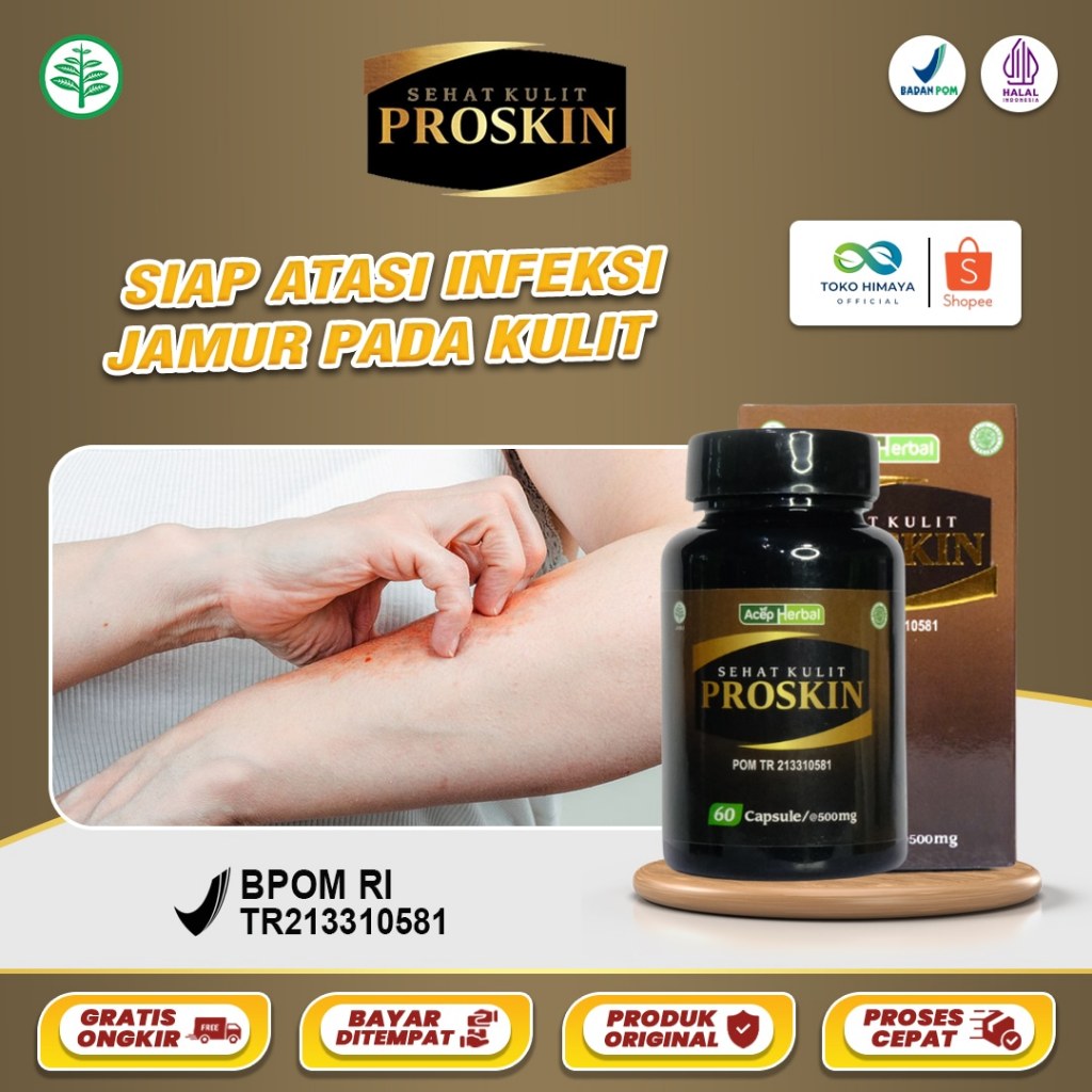 PROSKIN Obat Infeksi Jamur Candida Panu / Hapur Gatal Karena Jamur Penghilang Jamur Di Kulit