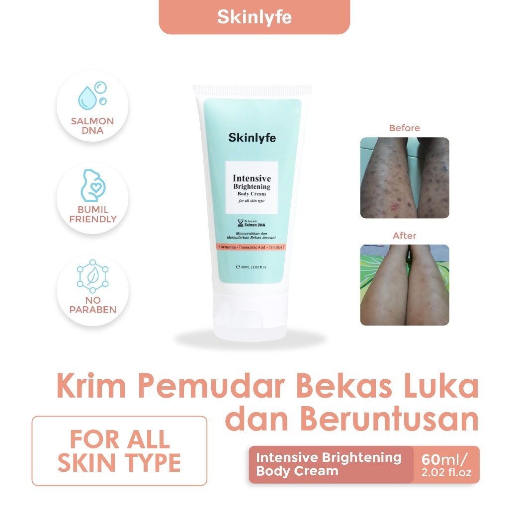 Skinlyfe Penghilang Bekas Luka Pencerah Badan Pemudar Bekas Luka dan Koreng Salep Penghilang Koreng