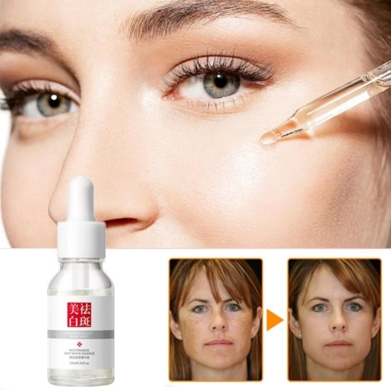 Serum Fuyan Nicotinamide Whitening Cream Glowing