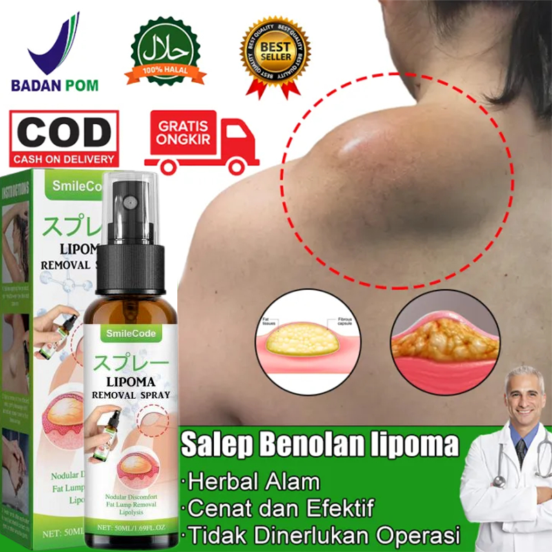 （COD）Salep lipoma Lipoma Spray lipoma cream salep benjolan Lymphatic ointment cream obat Benjolan Li