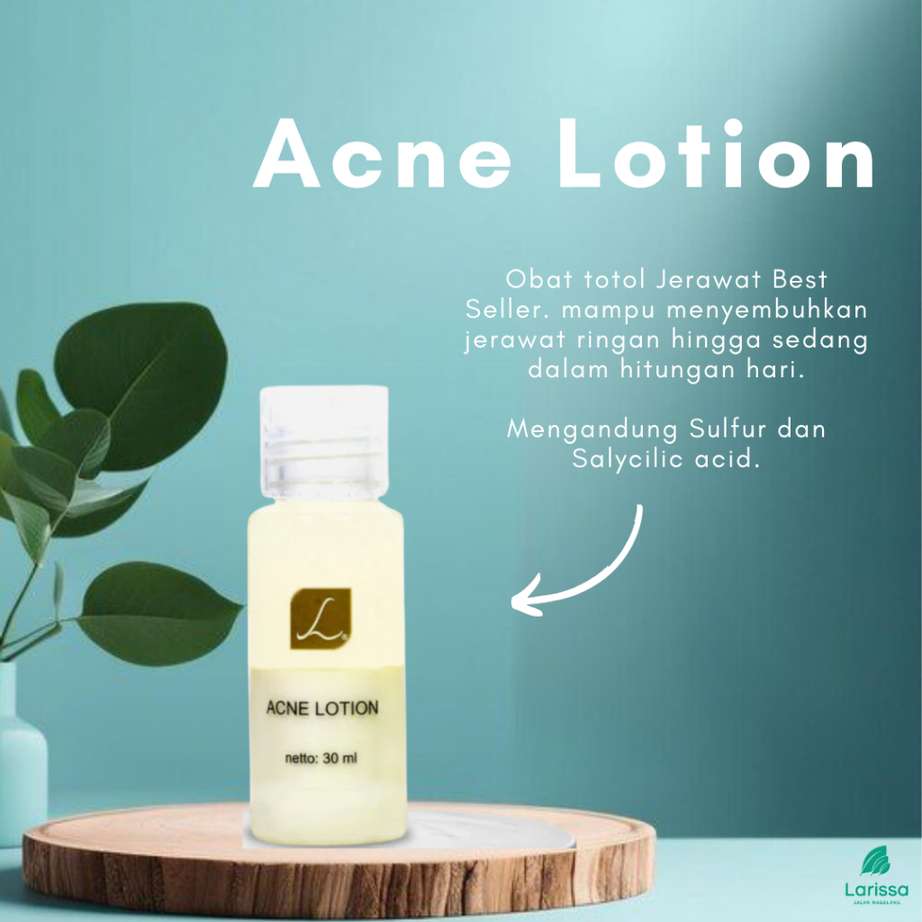 Acne Lotion Larissa / totol Jerawat Larissa (Obat Jerawat Larissa) Larissa Jamal