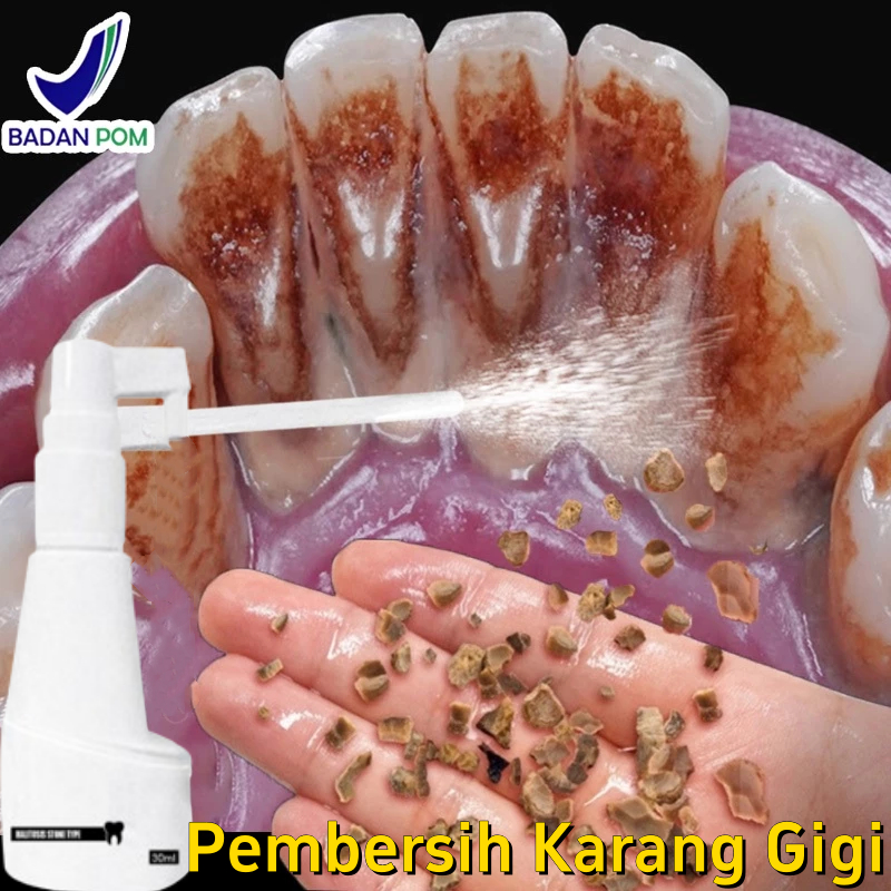 Pembersih Karang Gigi 30ml Penghilang Karang Gigi Perontok Karang Gigi Paling Ampuh 30ml Alat Pember