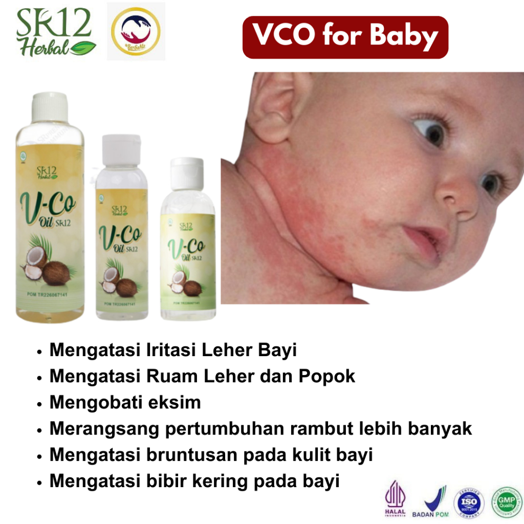 Minyak Kelapa Virgin Coconut Oil VCO Obat Oles untuk Ruam Leher dan Popok pada Bayi serta Dewasa