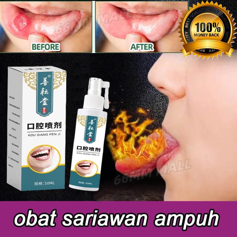 obat sariawan anak ampuh obat gusi bengkak Sariawan mulut gom sariawan obat sariawan di lidah bau mu