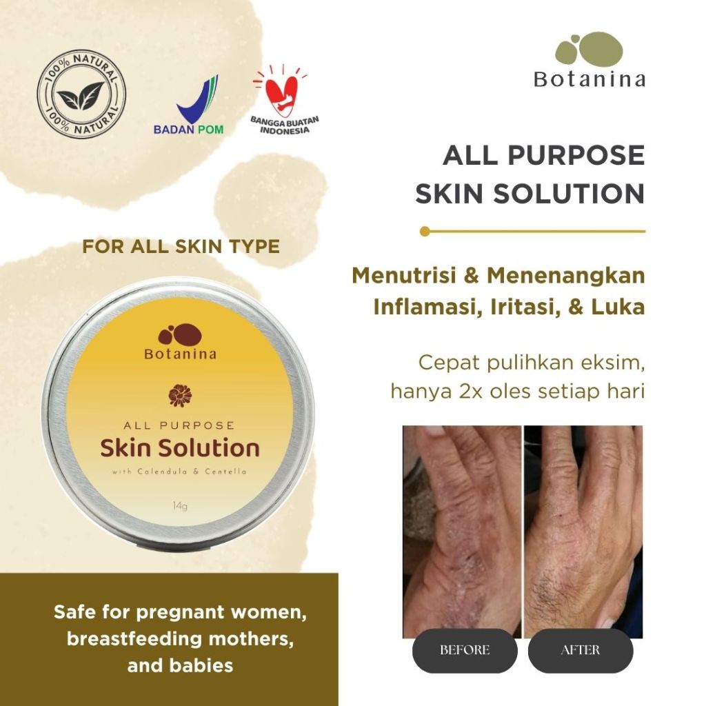 Botanina All Purpose Skin Solution | Salep Ruam Iritasi Gatal Luka Eksim Alami | Aman untuk Bayi