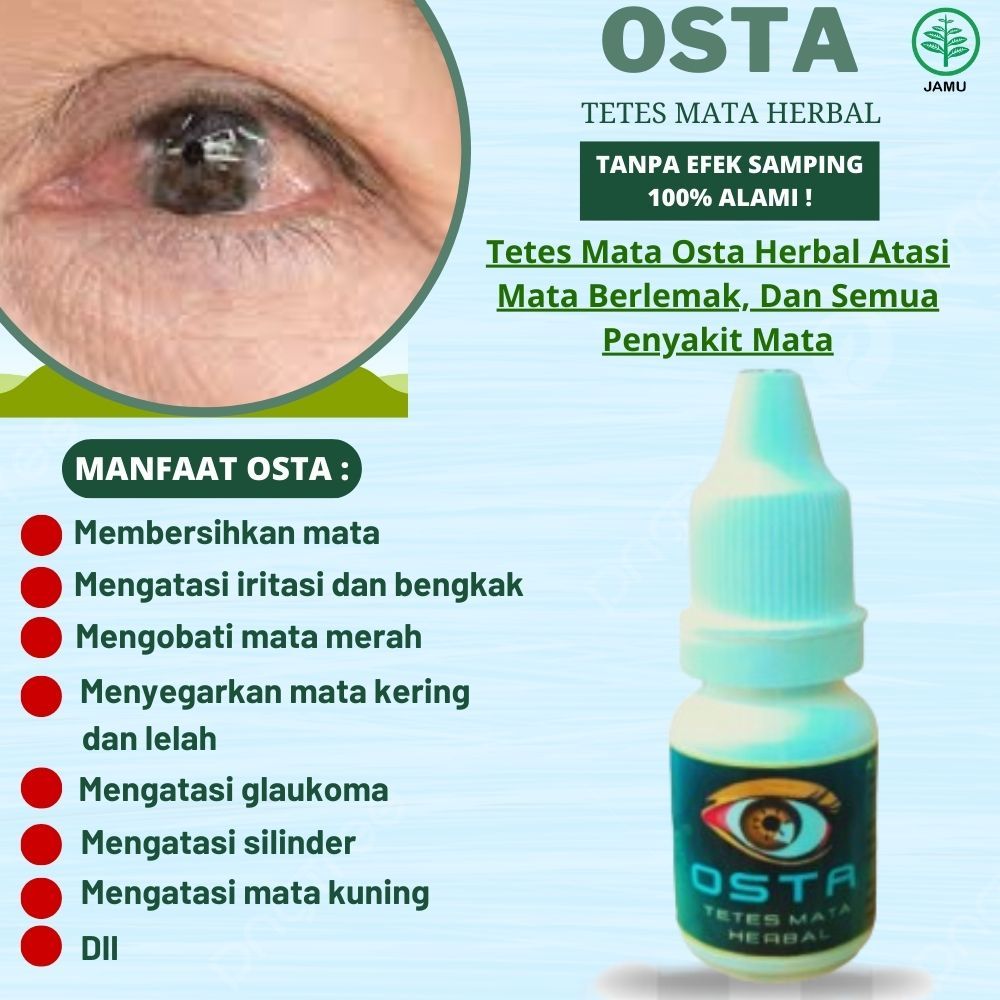 OSTA Obat Tetes Mata Paling Ampuh - Mengobati Mata Berlemak, Dan Semua Penyakit Mata