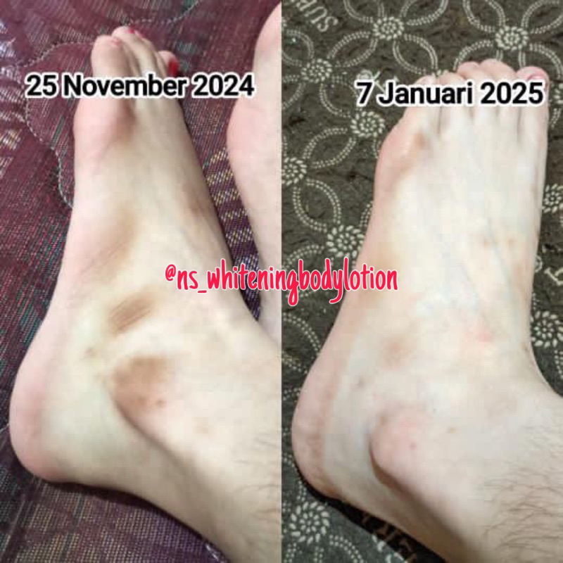 NS Whitening Body Lotion