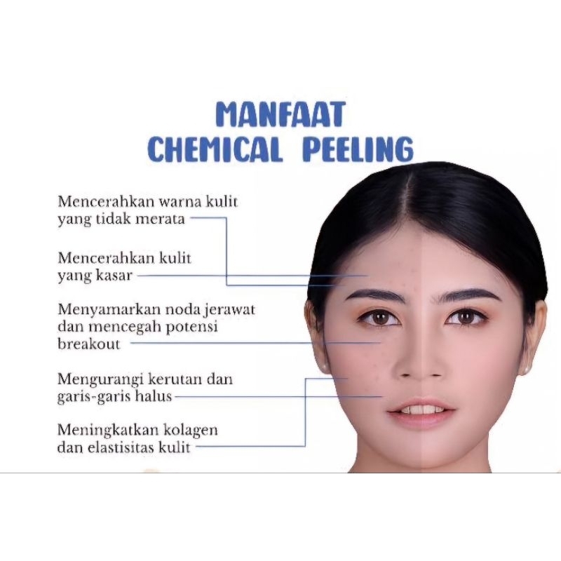 VASA YASA TAS FASHION KECANTIKAN CHEMICAL PEELING EXFOLIASI PEELING PERAWATAN KULIT PENCERAH KULIT P