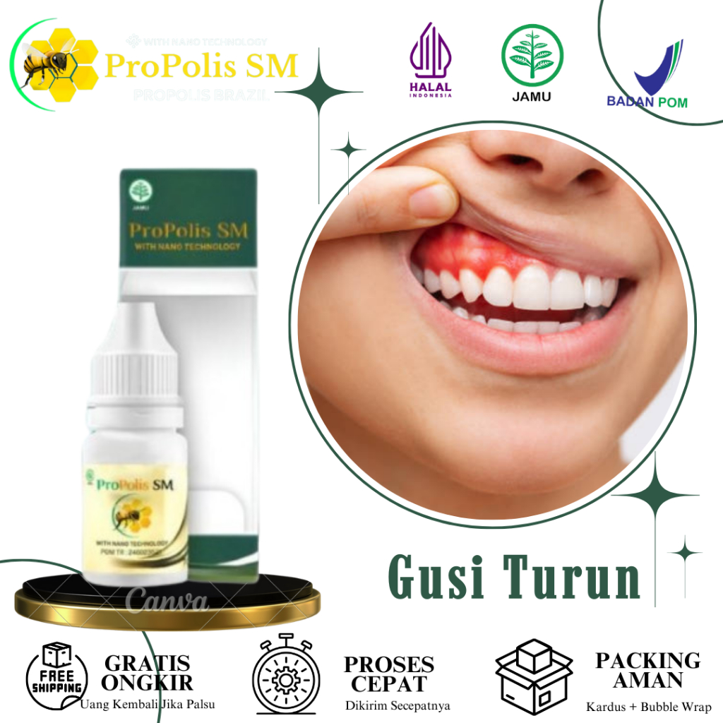 ProPolis SM - Obat Gusi Turun, Resesi Gingiva, Gusi Bengkak Dan Memerah, Nyeri Garis Gusi, Bau Mulut