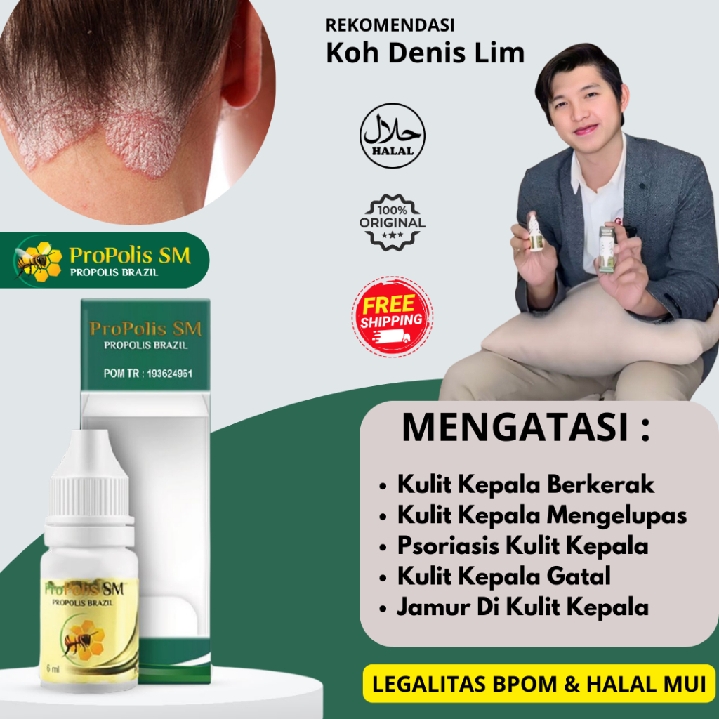 Obat Salep/Oles Psoriasis Kulit Kepala Kering Berkerak Bersisik Jamur Bersisik Ketombe Parah Herbal