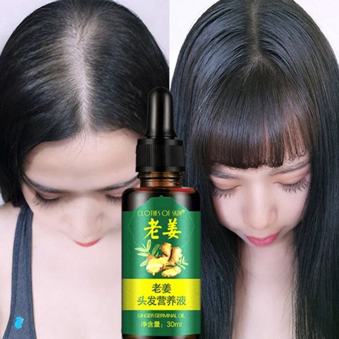 Paket Meriah OBAT PENUMBUH RAMBUT BOTAK SERUM PENUMBUH RAMBUT KEPALA