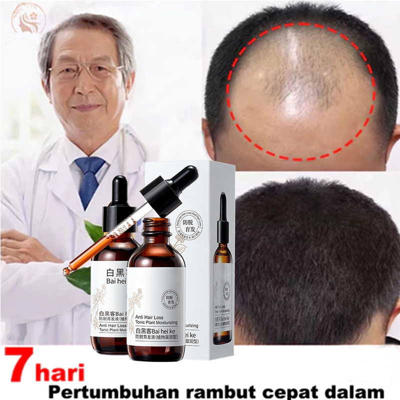 [100% ORI] Shampo Penumbuh Rambut Cepat Serum Serum penumbuh rambut Rambut Rontok Botak Rontok Penum