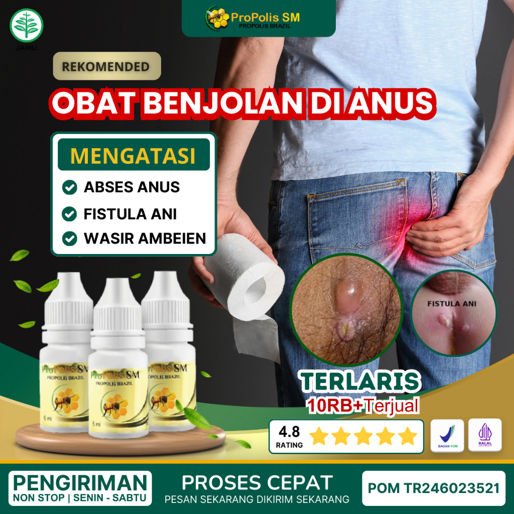 Obat Penghilang Abses Anus, Benjolan Pantat Bernanah, Obat Bisul Di Pantat , Abses Prianal, Luka Di 