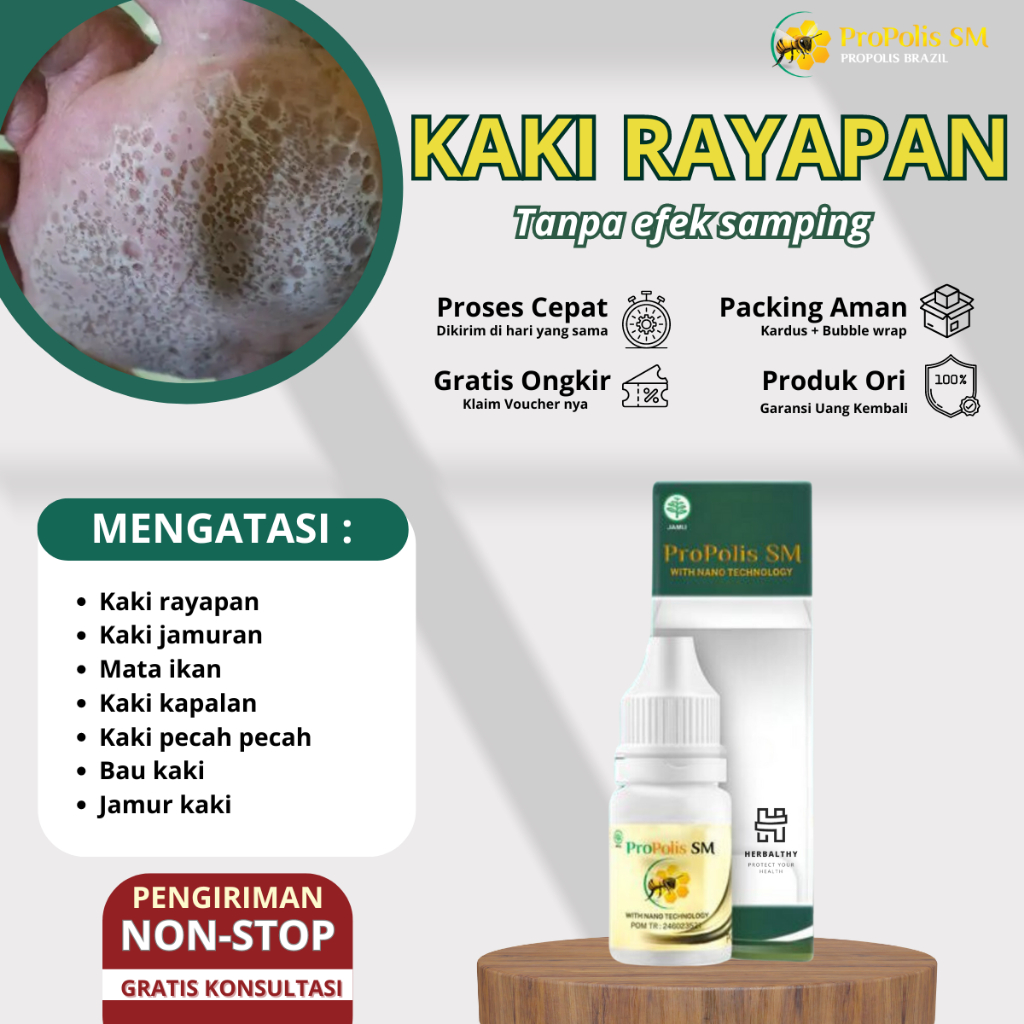 Obat Kaki Rayapan Obat Penghilang Rayapan Obat Kaki Berlubang Obat Kaki Bolong Ikan Obat Kaki Jamura