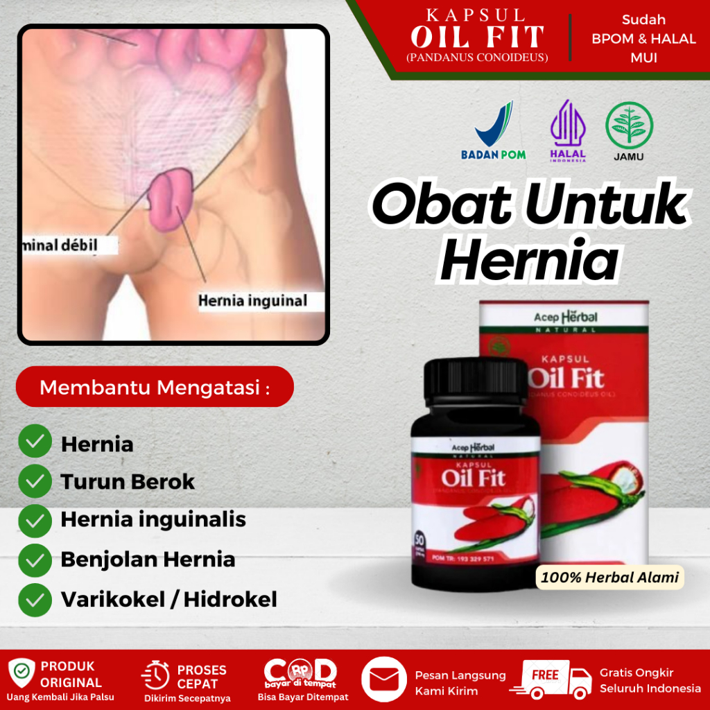 Obat Herbal Untuk Hernia, Buah Zakar Bengkak Sebelah, Hernia Inguinalis, Benjolan Hernia, Benjolan B