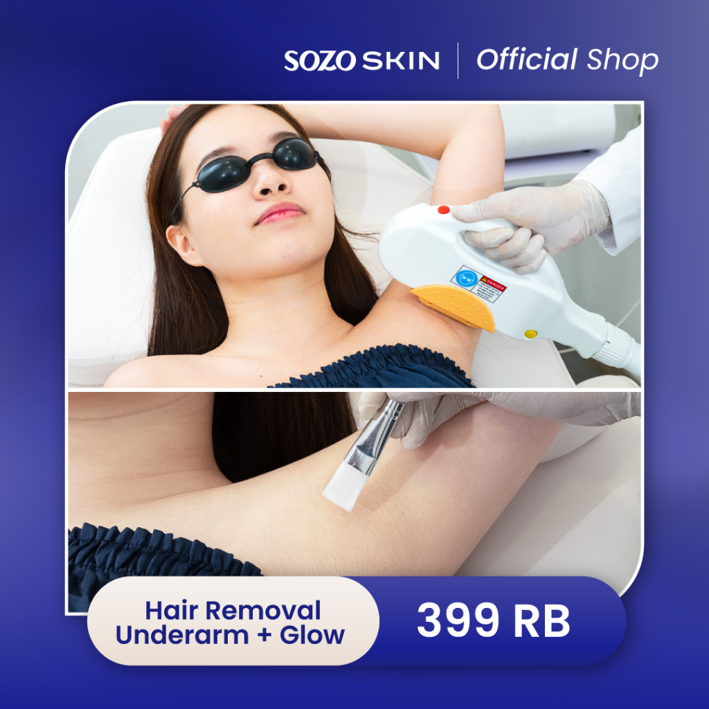 SOZO SKIN IPL Hair Removal Underarm + Glow