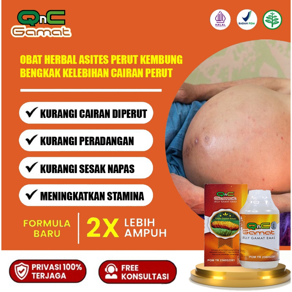 Obat Asites Perut Bengkak Busung Air Perut Kelebihan Cairan Di Perut | QnC Gamat Jelly Gamat Emas