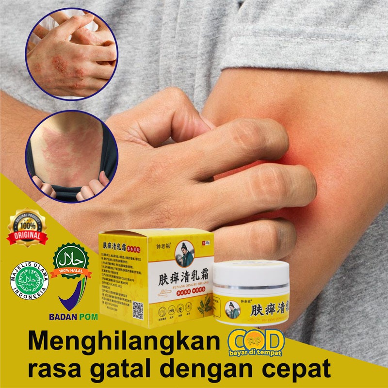 Salep Eksim Kering dan Gatal Salep Gatal China Paling Ampuh Obat Gatal Selangkangan Salep Bayi Untuk