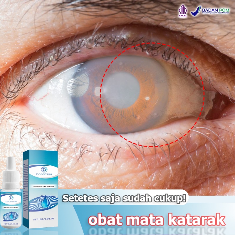 Obat mata katarak Obat mata minus Obat tetes mata Tetes mata 15ml Obat mata Obat katarak Obat tetes 