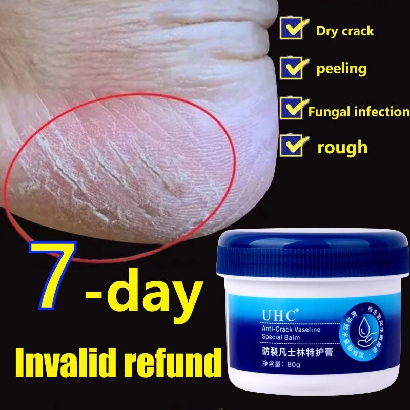 Vaseline kaki kering dan pecah cream pelembab kaki kering dan kasar obat kaki pecah foot cream obat 