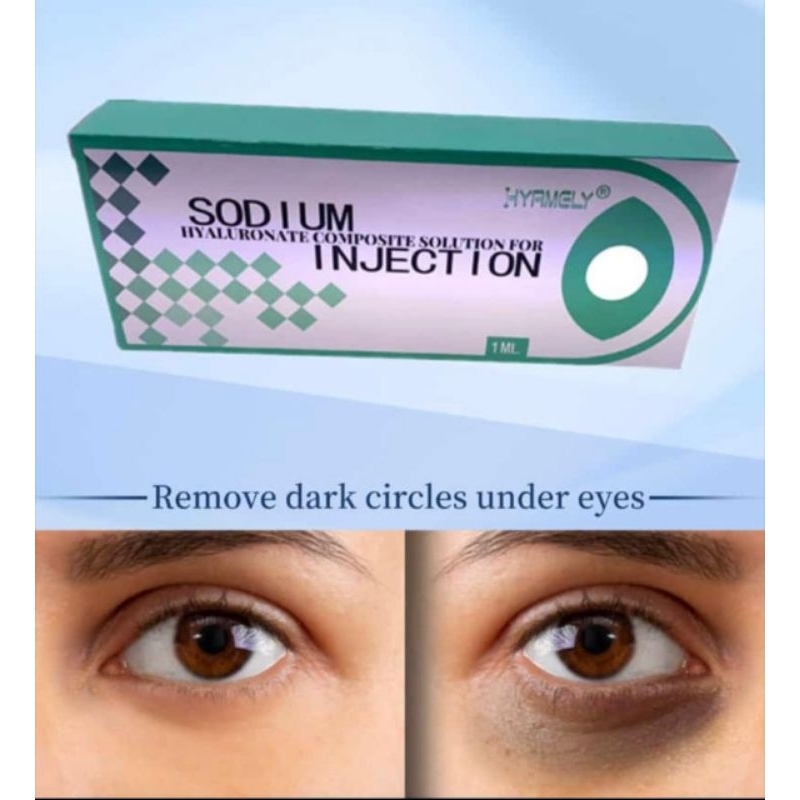 penghilang kantung mata ampuh,filer penghilang kantung mata hitam