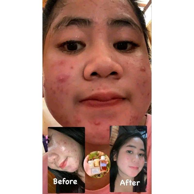 cream sr cream sr glowing original cream sr super cream sr pengecil pori pori cream sr