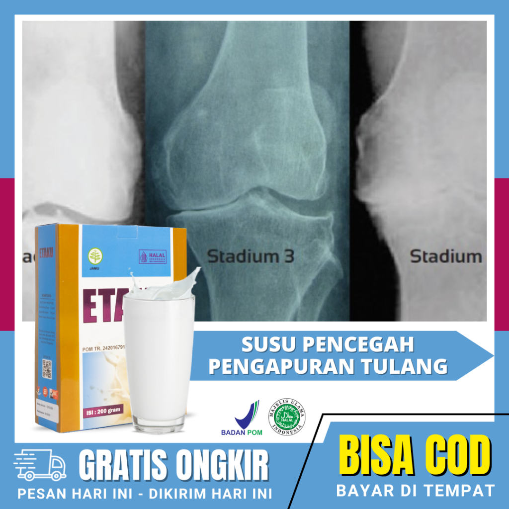 

Obat Pengapuran Tulang & Sendi, Tulang Keropos, Osteoporosis - Etaku Goat Milk- Susu Kambing Asli