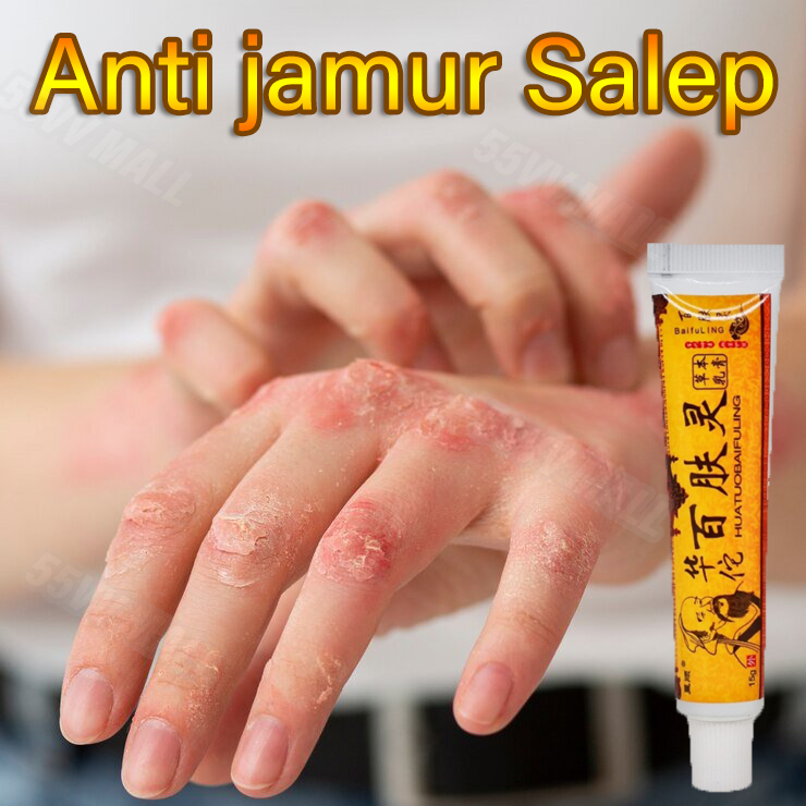 salap gatal kulit yang ampuh salep eksim salep gatal paling ampuh Salep Cream Jamur Kurap Menghilang
