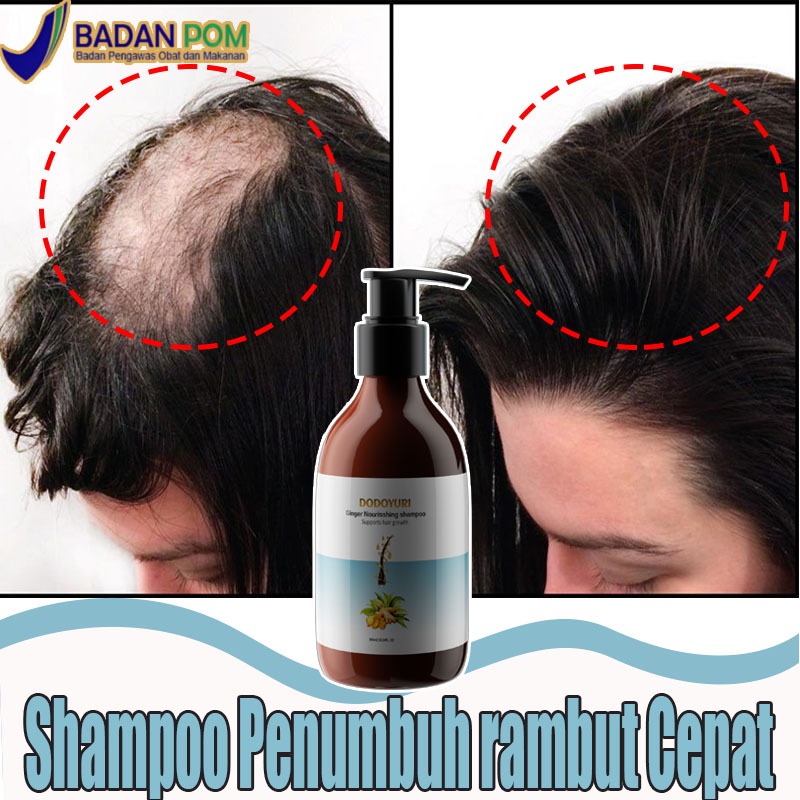 Shampoo penumbuh rambut cepat Shampo anti rontok Rambut rontok dan penumbuh rambut Penumbuh rambut c