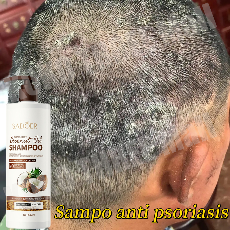 shampo anti ketombe Sampo Anti Ketombe Shampo Kelapa Pelembab anti gatal Coconut shampo kutu rambut 