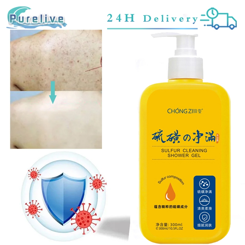 300ml Sabun Sulfur Cair Sabun Gatal Sulfur Sabun Penghilang Tungau Sabun Cair Belerang