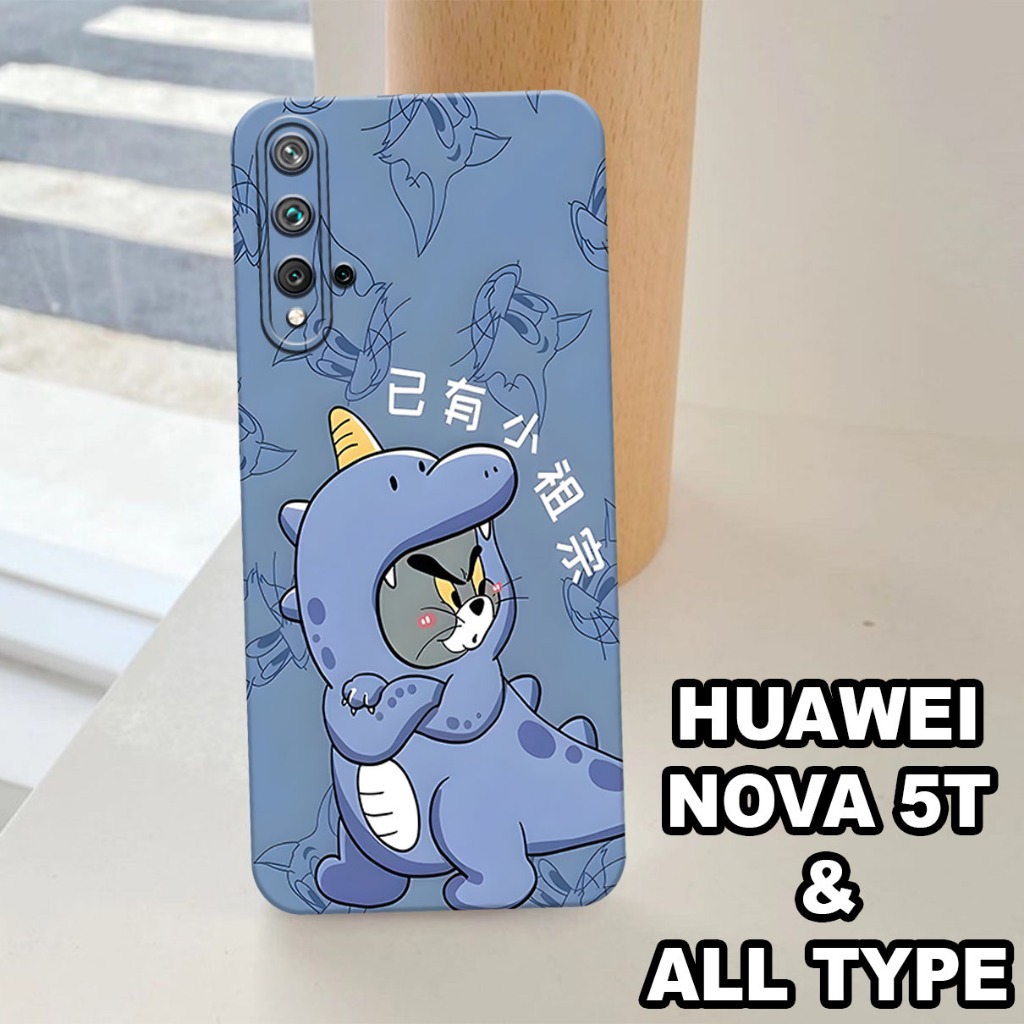 G58 - Silikon HUAWEI NOVA 5T - Softcase pro camera HUAWEI NOVA 5T - Motif COUPLE - Bahan  Karet Lent