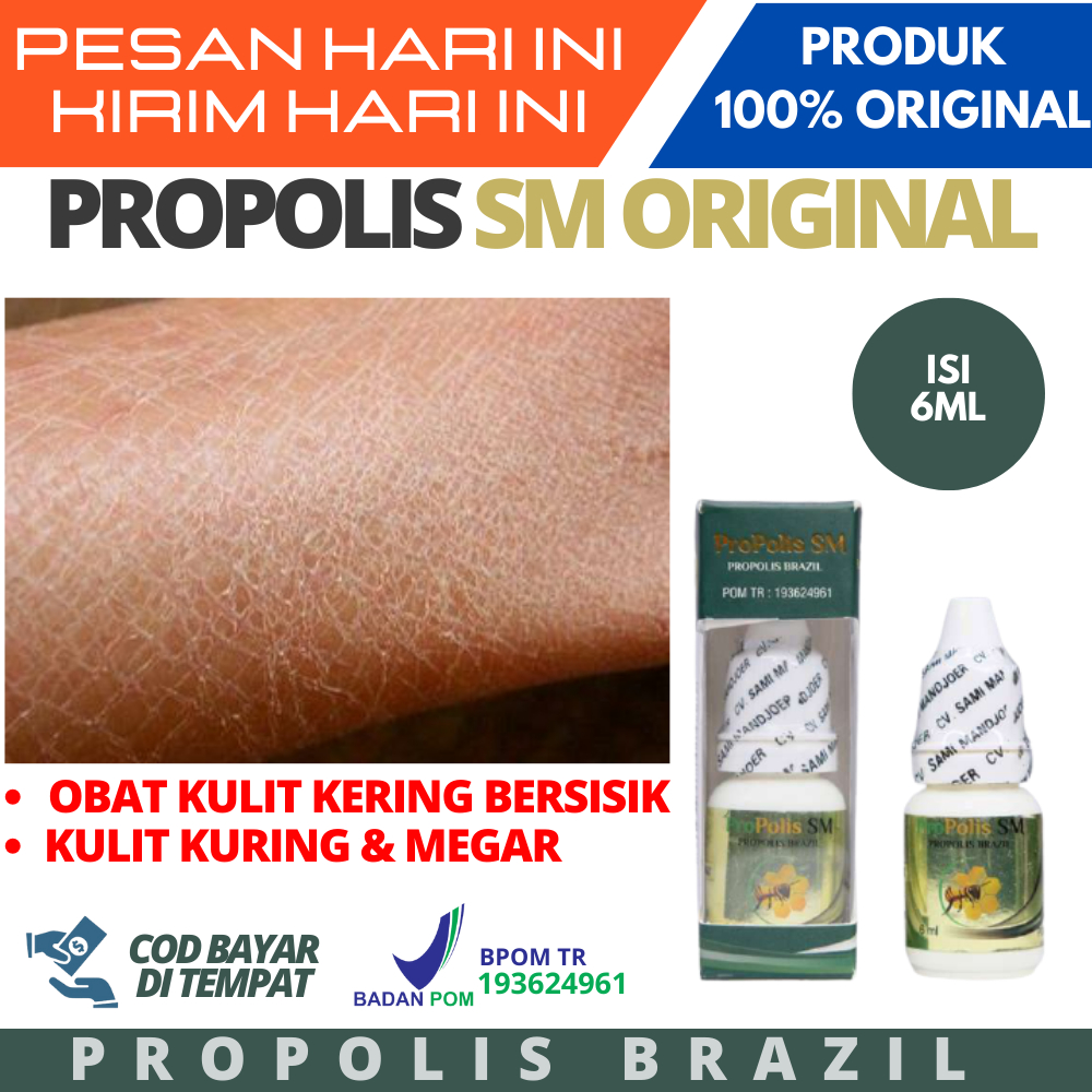 Obat Untuk Kulit Kering, Menebal, Kasar dan Bersisik / Iktiosis / Obat Kulit Kerig Pecah-pecah dan G