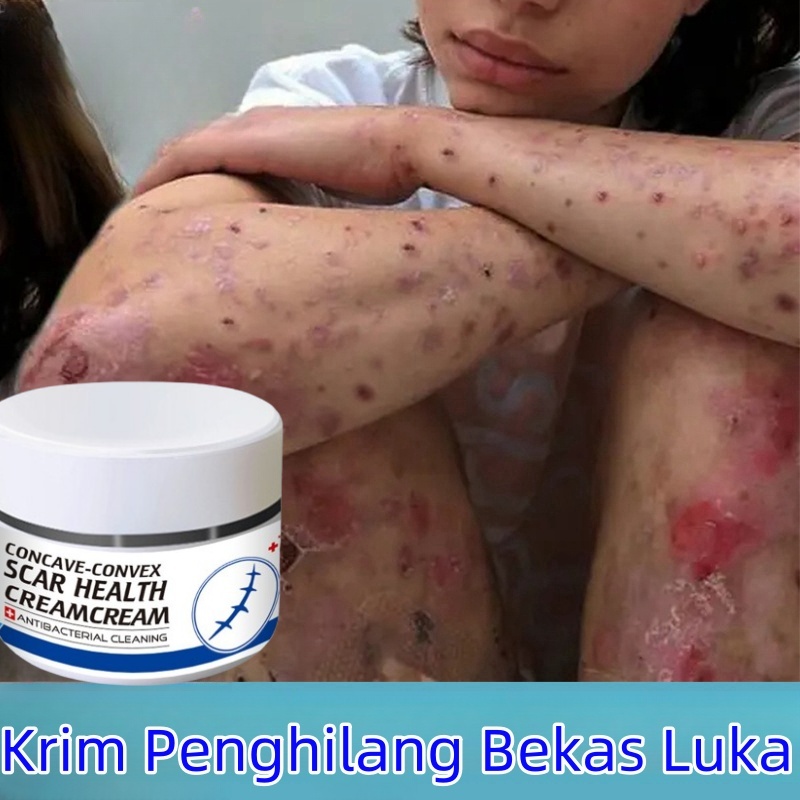 Salep penghilang bekas luka hitam menghilangkan bekas luka dan koreng penghilang bekas jerawat salep