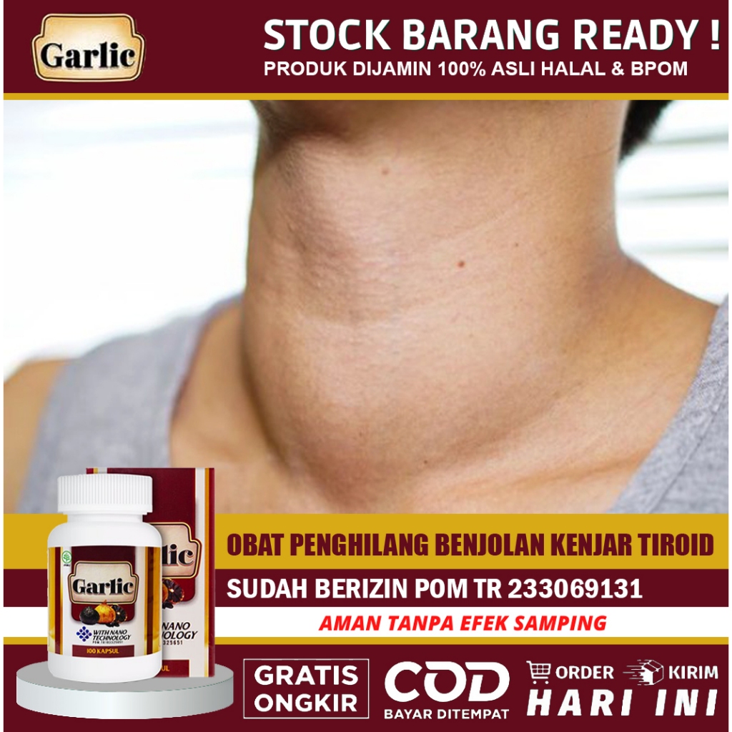 GARLIC Obat Gondok Benjolan Leher Kelenjar Hipertiroid Penyakit Gondok Bengkak Kelenjar Tiroid