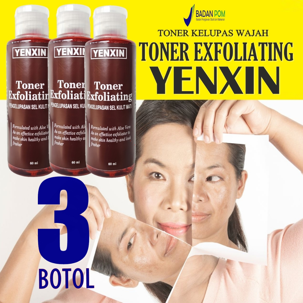 3 BOTOL TONER PENGELUPASAN EXTRA CEPAT TONER EXFOLIATING FLEK FLEK HITAM DAN BINTIK BINTIK HITAM MEM