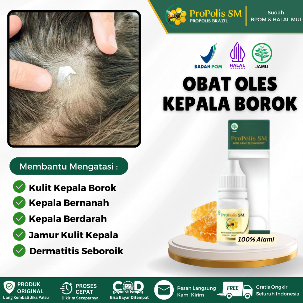 Obat tetes kulit kepala borok, Obat kepala borok bernanah dan berdarah, kulit kepala bersisik/Psoria