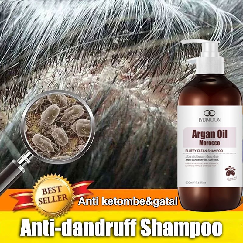 shampoo anti ketombe sampo anti ketombe dan gatal sampo anti ketombe ampuh ampuh sampo anti ketombe 