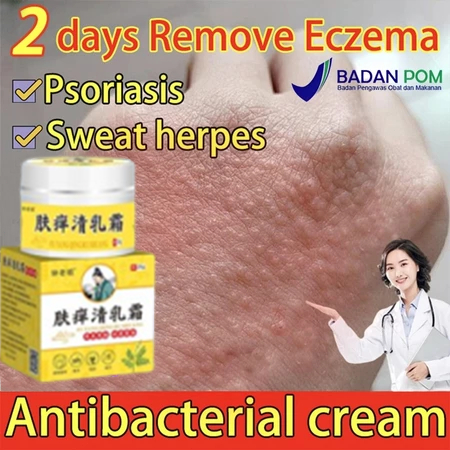 Salep gatal paling ampuh Obat gatal kulit Obat gatal selangkangan 25g Obat gatal paling ampuh Obat g