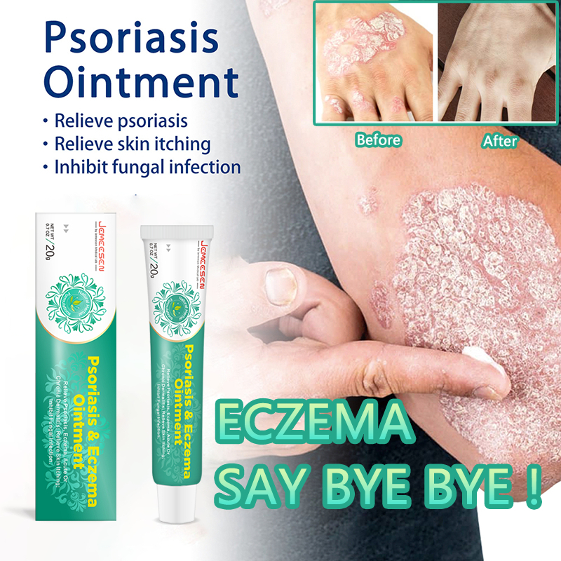 Jemeesen Obat Gatal Salep Psoriasis Eczema Cream Paling Ampuh Kulit Kepala Psoriasis Herbal Obat Gat