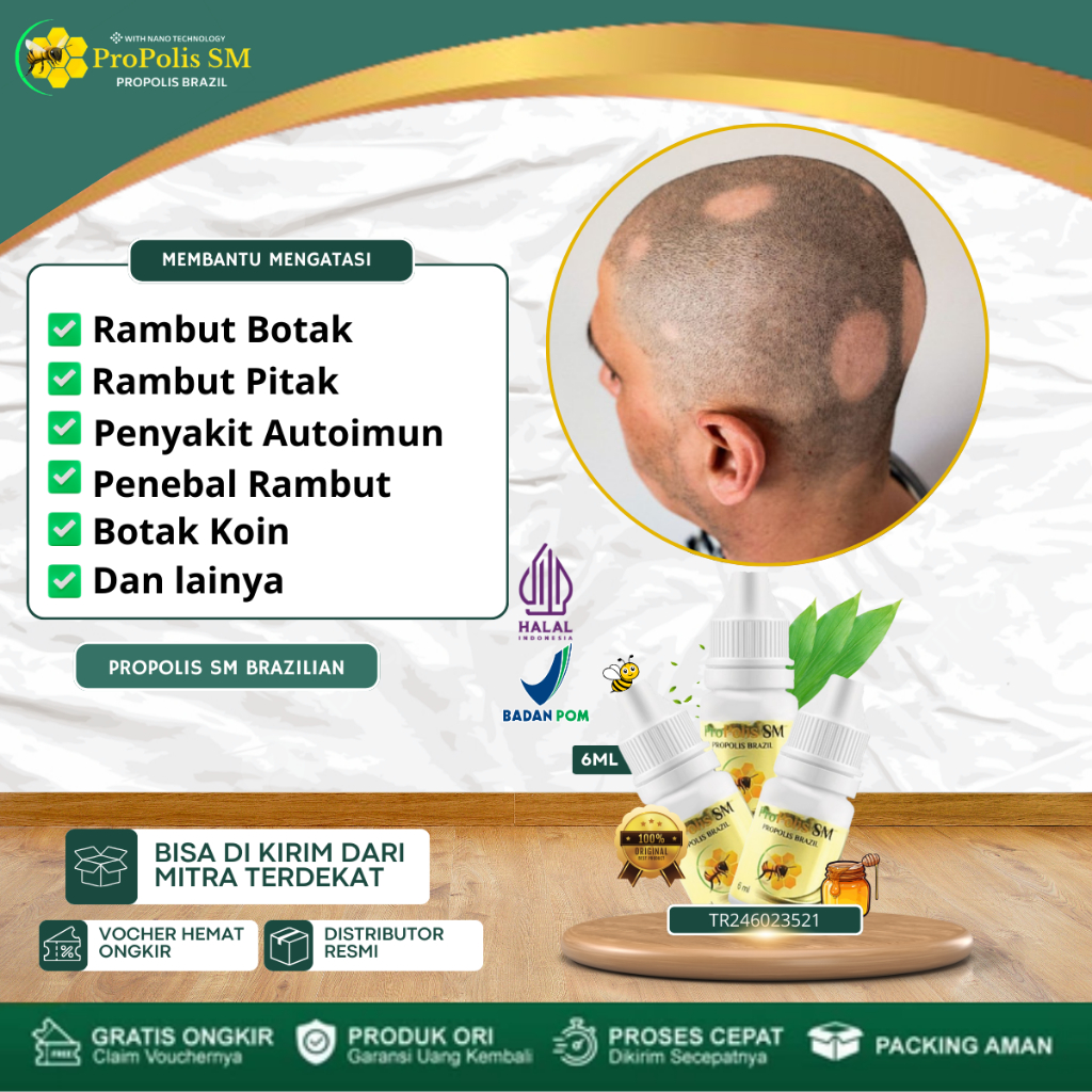 Obat Penumbuh Rambut Botak Pitak, Obat Alopecia Areata, Obat Penumbuh Rambut Botak, Botak Koin, Obat