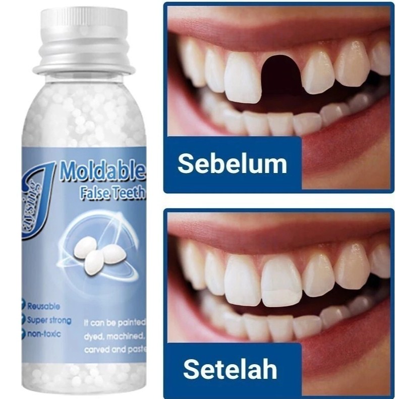 PENAMBAL GIGI BERLUBANG / GIGI BOLONG / GIGI BERJARAK / GIGI PALSU GIGI TEMPEL / TAMBALAN GIGI PERMA