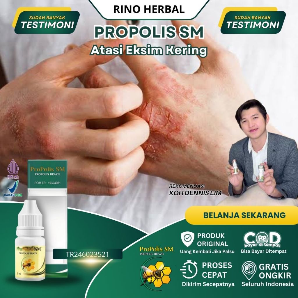obat eksim kering, obat eksim basah, obat gatal eksim kering menahun dengan propolis sm brazilian